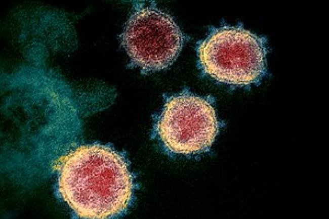 Coronavirus: les cas confirmés approchent la barre de 500 en RDC