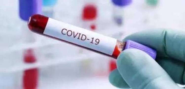 Le nombre de cas confirmés du Coronavirus secoue sensiblement la RDC