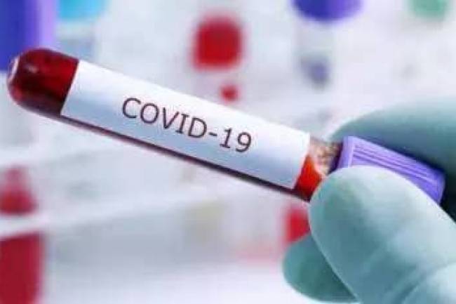 Le nombre de cas confirmés du Coronavirus secoue sensiblement la RDC
